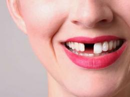 Во сне выпадают зубы без крови — что это значит?