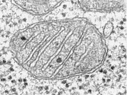 Aké bunky obsahujú mitochondrie?